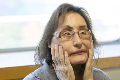 美国首位换脸人逝世,曾被丈夫枪射面部,为获新生接受30次手术
